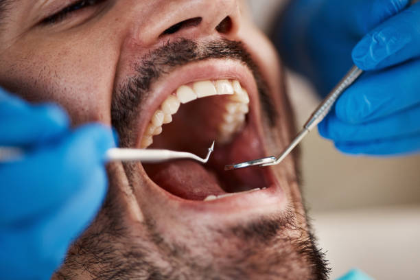 Best Broken Tooth Emergency  in Pontoon Beach, IL